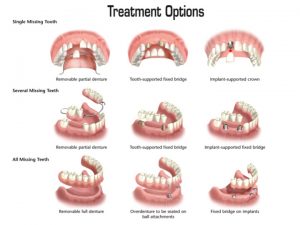 Treatment Options